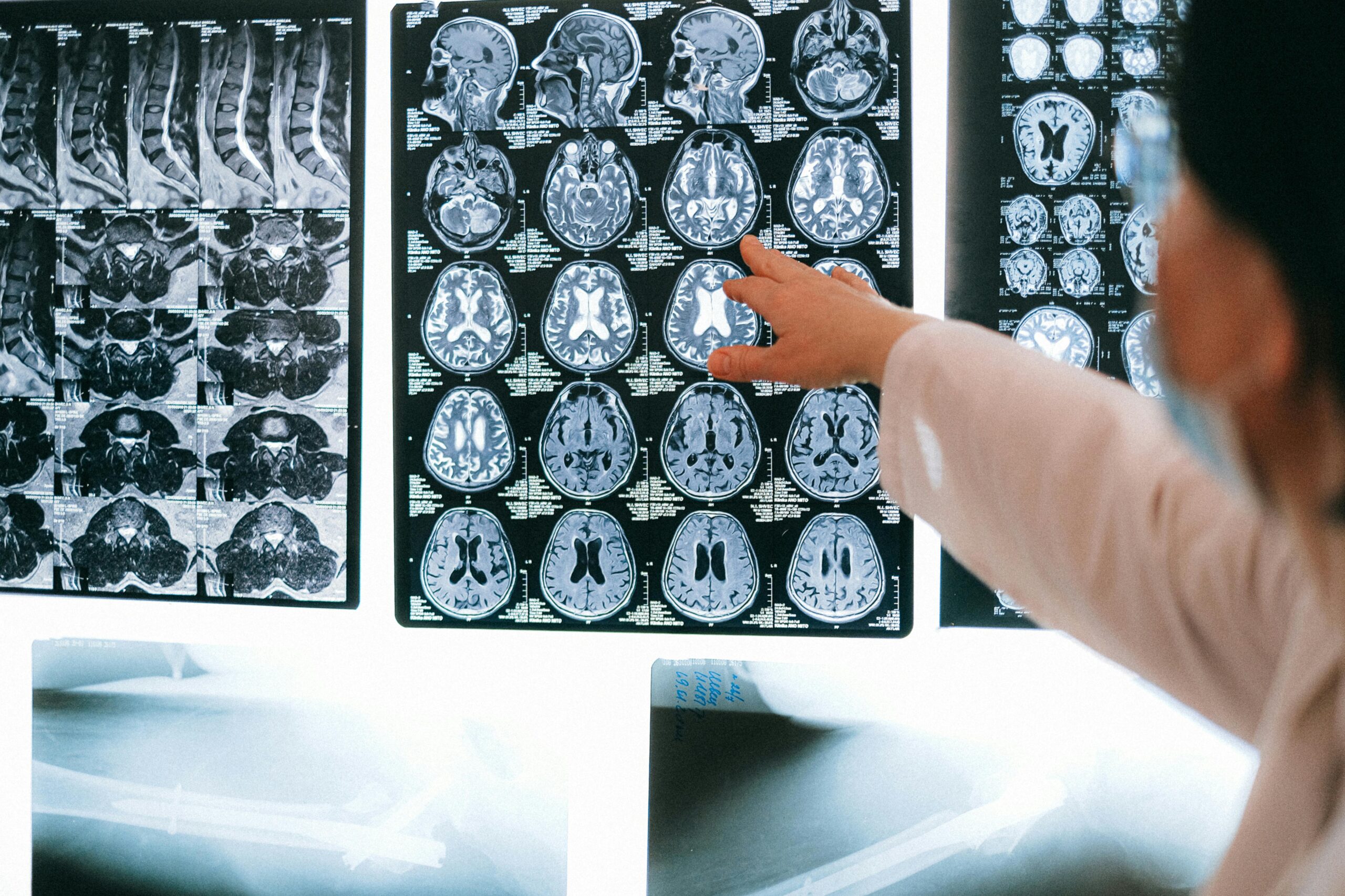 A doctor is looking at a brain scan A doctor is looking at a brain scan